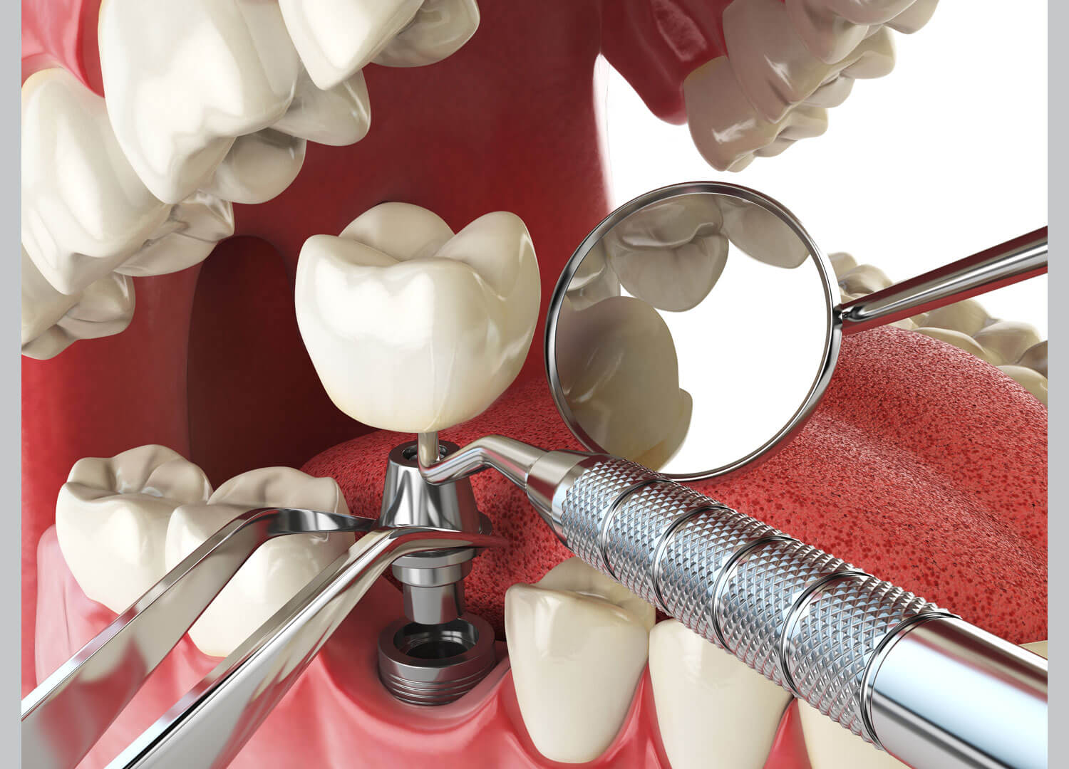 dental